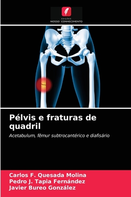 Pélvis e fraturas de quadril Pélvis e fraturas de quadril cover