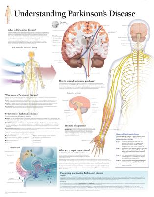 Understanding Parkinson's Chart: Wall Chart Cover Image