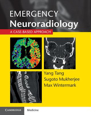 Emergency Neuroradiology: A Case-Based Approach By Yang Tang (Editor), Sugoto Mukherjee (Editor), Max Wintermark (Editor) Cover Image