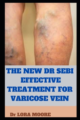 The New Dr Sebi Effective Treatment for Varicose Vein Cover Image