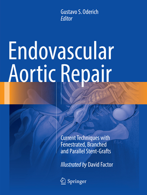 Endovascular Aortic Repair: Current Techniques with Fenestrated, Branched and Parallel Stent-Grafts Cover Image