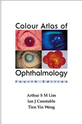 Atlas of Ophthalmology