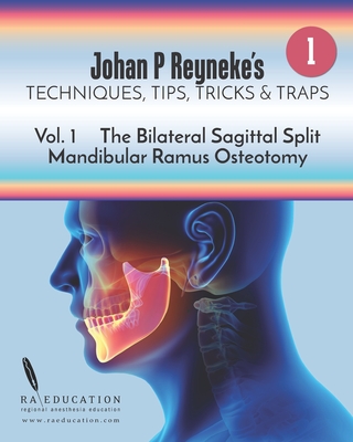 Johan P Reyneke's Techniques, Tips, Tricks and Traps: Volume 1: The Bilateral Sagittal Split Mandibular Ramus Osteotomy Cover Image