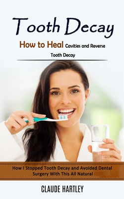 Tooth Decay: How to Heal Cavities and Reverse Tooth Decay (How I Stopped Tooth Decay and Avoided Dental Surgery With This All Natur Cover Image