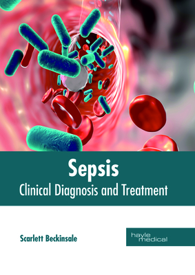 Sepsis: Clinical Diagnosis and Treatment Cover Image
