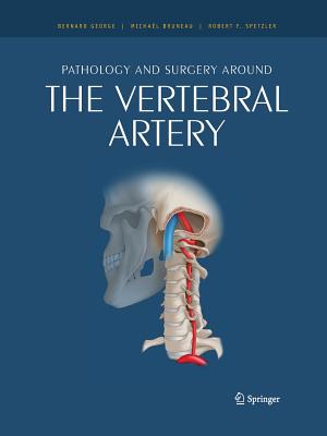 Pathology and Surgery Around the Vertebral Artery Cover Image