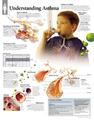 Understanding Asthma Chart: Laminated Wall Chart Cover Image