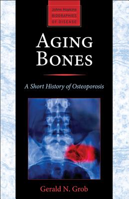 Aging Bones A Short History Of Osteoporosis Johns Hopkins Biographies Of Disease Paperback Snowbound Books