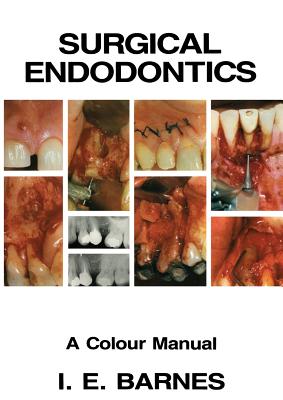 Surgical Endodontics: A Colour Manual By I. Barnes Cover Image