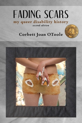 Fading Scars: My Queer Disability History, 2nd Edition Cover Image