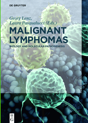 Malignant Lymphomas: Biology and Molecular Pathogenesis Cover Image