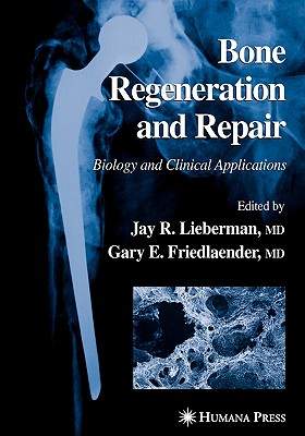 Bone Regeneration and Repair: Biology and Clinical Applications Cover Image