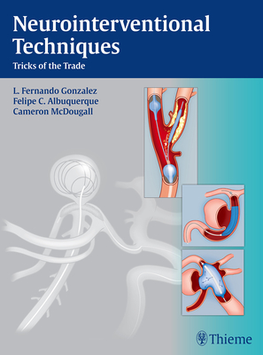 Neurointerventional Techniques: Tricks of the Trade Cover Image