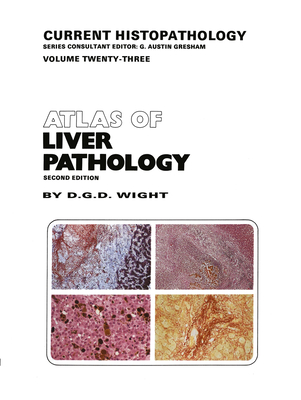 Atlas of Liver Pathology (Environment & Policy #23)