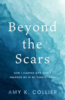 Beyond the Scars: How I Learned God Didn't Abandoned Me in My Darkest Hour Cover Image