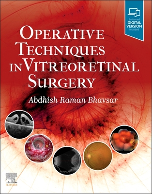 Operative Techniques in Vitreoretinal Surgery Cover Image