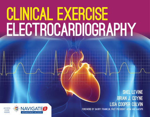 Clinical Exercise Electrocardiography (Paperback) | Pegasus Books