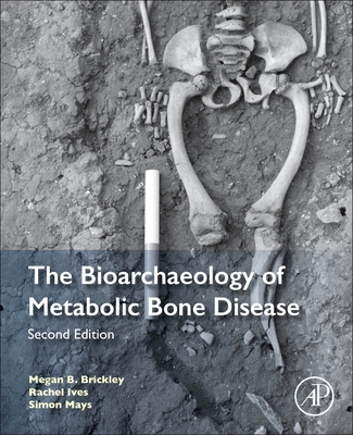 The Bioarchaeology of Metabolic Bone Disease Cover Image
