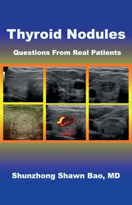 Thyroid Nodules: Questions From Real Patients Cover Image