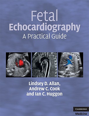 Fetal Echocardiography: A Practical Guide [With DVD] Cover Image