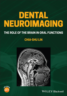Dental Neuroimaging: The Role of the Brain in Oral Functions Cover Image