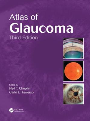 Atlas of Glaucoma By Neil T. Choplin (Editor), Carlo E. Traverso (Editor) Cover Image