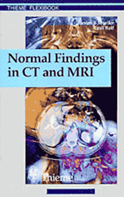 Normal Findings in CT and Mri, A1, Print (Thieme Flexibook) By Torsten Bert Möller (Editor), Torsten Bert Moeller, Emil Reif Cover Image