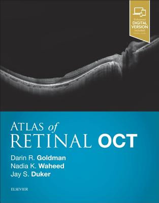 Atlas of Retinal Oct: Optical Coherence Tomography Cover Image