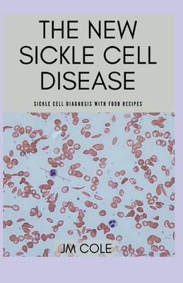 The New Sickle Cell Disease: Sickle Cell Diagnosis with Food Recipes Cover Image