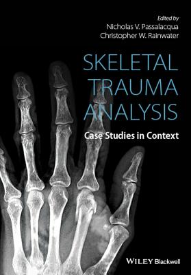 Skeletal Trauma Analysis Cover Image