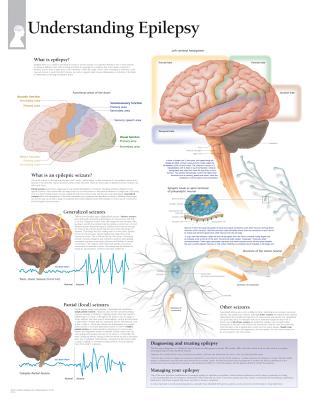 Understanding Epilepsy Chart: Laminated Wall Chart Cover Image