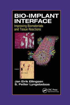 Bio-Implant Interface: Improving Biomaterials and Tissue Reactions Cover Image