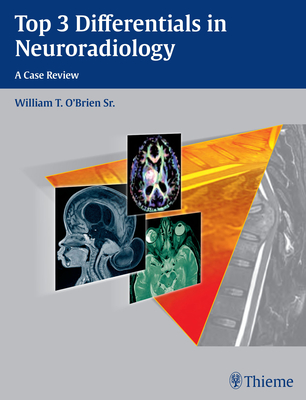 Top 3 Differentials in Neuroradiology
