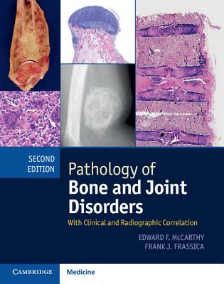 Pathology of Bone and Joint Disorders Print and Online Bundle: With Clinical and Radiographic Correlation Cover Image