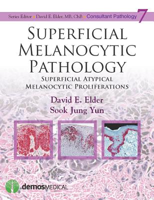 Superficial Melanocytic Pathology (Consultant Pathology #7)