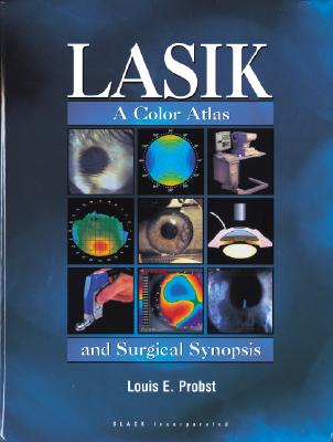 LASIK:  A Color Atlas and Surgical Synopsis