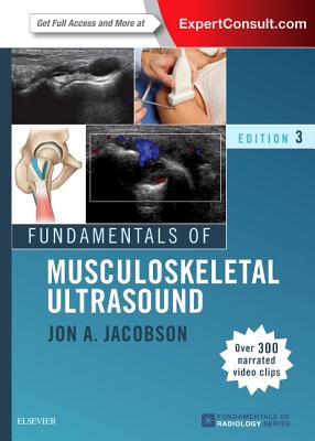 Fundamentals of Musculoskeletal Ultrasound (Fundamentals of Radiology) Cover Image