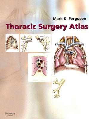 Thoracic Surgery Atlas Cover Image