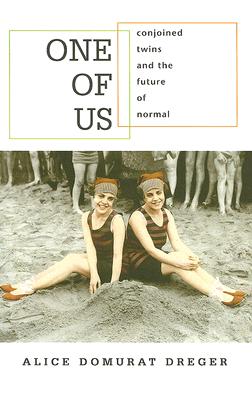 One of Us: Conjoined Twins and the Future of Normal Cover Image