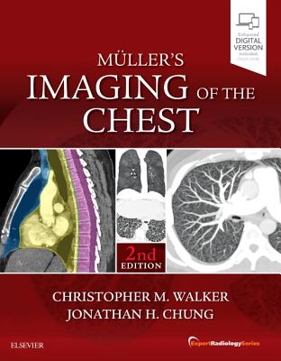Muller's Imaging of the Chest: Expert Radiology Series Cover Image