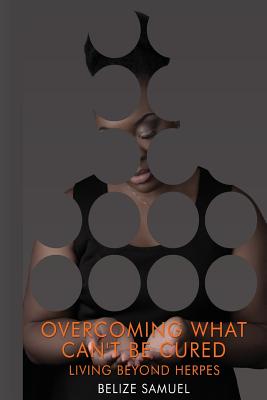 Overcoming What Can't be Cured: Living Beyond Herpes By Belize Samuel Cover Image