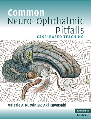 Common Neuro-Ophthalmic Pitfalls: Case-Based Teaching (Cambridge Medicine)