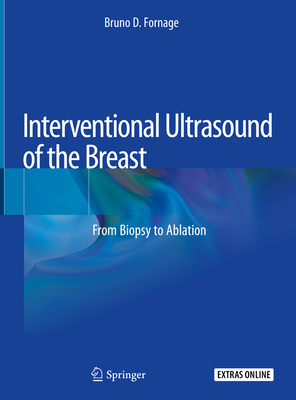 Interventional Ultrasound of the Breast: From Biopsy to Ablation Cover Image