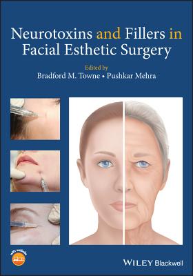 Neurotoxins and Fillers in Facial Esthetic Surgery Cover Image