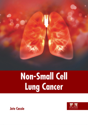 Non-Small Cell Lung Cancer Cover Image