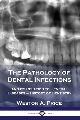 The Pathology of Dental Infections: and Its Relation to General Diseases - History of Dentistry Cover Image