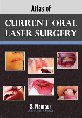 Cover for Atlas of Current Oral Laser Surgery