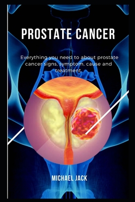Prostate Cancer: Everything You Need To About Prostate Cancer Signs, Symptom, Cause And Treatment. Cover Image