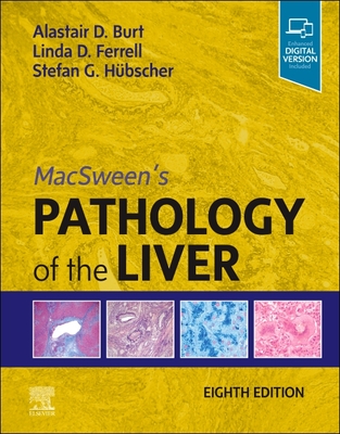 Macsween's Pathology of the Liver Cover Image