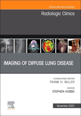 Imaging of Diffuse Lung Disease, an Issue of Radiologic Clinics of North America: Volume 60-6 (Clinics: Internal Medicine #60) By Stephen Hobbs (Editor) Cover Image
